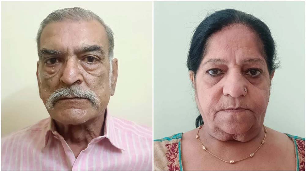 72 वर्षीय ताराचंद खत्री ने 65 वर्षीय पत्नी सीमा की कैंची घोंपकर हत्या कर दी, खुद चौथी मंजिल से 