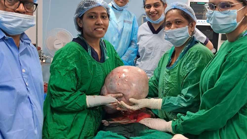 10 Kg का ट्यूमर हटाकर जीवन बदल दिया: दिल्ली के डॉक्टरों की कमाल की सर्जरी