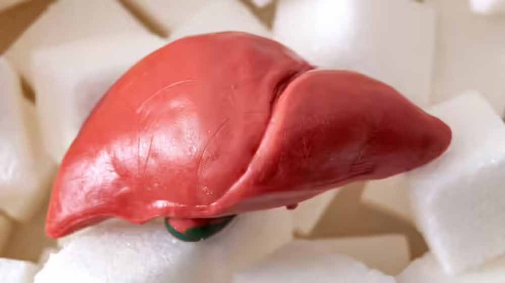 ज्यादा चीनी और मीठी ड्रिंक्स से लिवर पर बढ़ता खतरा, फैटी लिवर का रिस्क