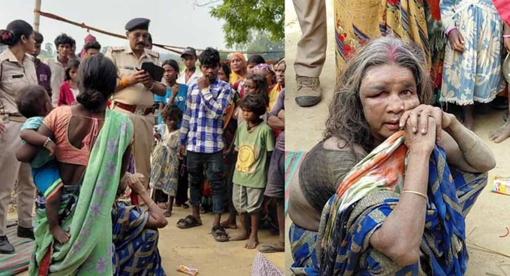 सिकंदरा थाना क्षेत्र के रवैय मुसहरी गांव में तनाव, पुलिस ने महिला को भीड़ से बचाकर अस्पताल पहुं