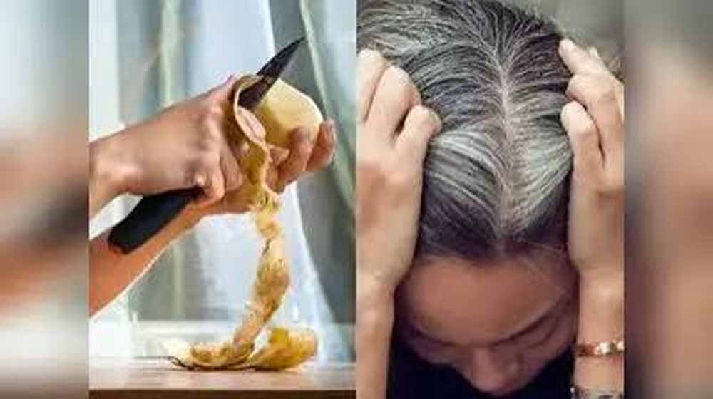 आलू के छिलके हैं कमाल: त्वचा, बाल और सेहत के लिए चौंकाने वाले फायदे