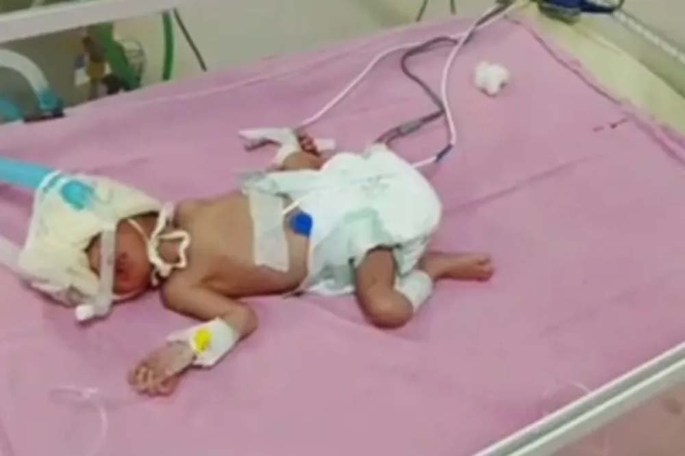 राजस्थान में दुर्लभ मामला, सिजेरियन से जन्मे तीन बेटियां और एक बेटा साथ