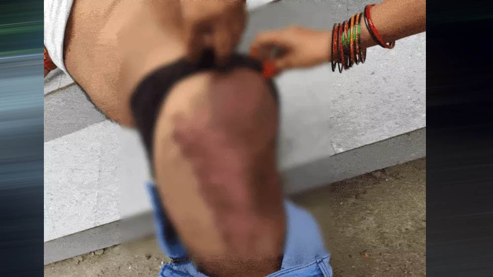 भिंड में सहायक सचिव के अपहरण से सनसनी, 13 घंटे तक यातना; बैट से हमला, पिस्टल दिखाकर जबरन दस्तखत