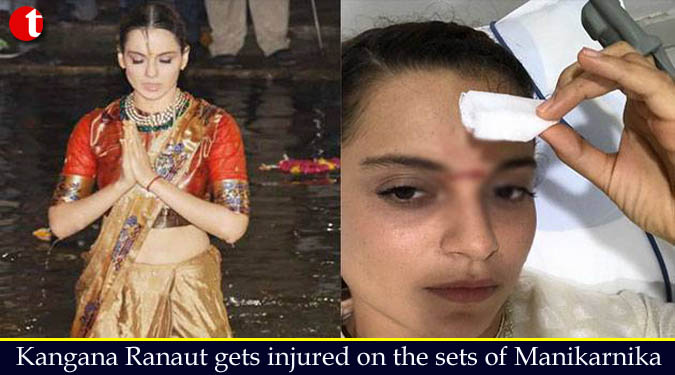 Kangana Ranaut gets injured on the sets of Manikarnika