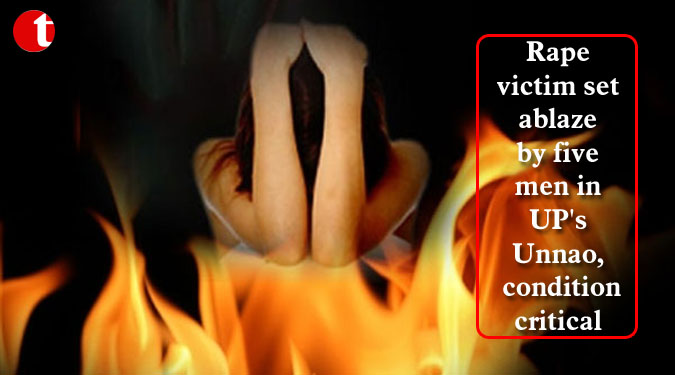 Rape victim set ablaze by five men in UP’s Unnao, condition critical
