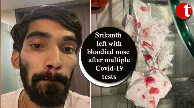 Srikanth left with bloodied nose after multiple Covid-19 tests