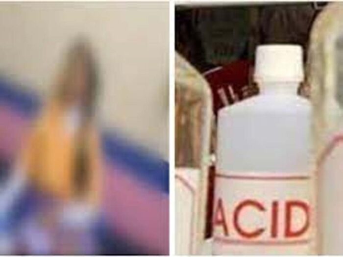 बेगूसराय जिले में एसिड हमले में झुलसी लड़की का अस्पताल में चल रहा इलाज, इलाके में मचा हड़कंप
