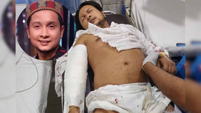पवनदीप राजन की भयानक एक्सीडेंट के बाद पहली बार सामने आई तस्वीर