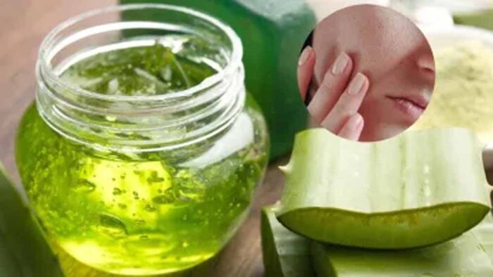 सनबर्न और टैनिंग से परेशान हैं? एलोवेरा जेल ऐसे करें इस्तेमाल