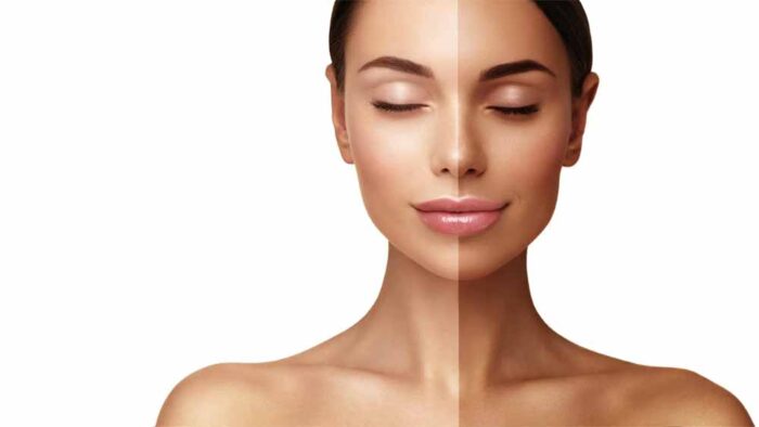 झुलसी त्वचा से छुटकारा: घर बैठे अपनाएँ ये 5 असरदार उपाय